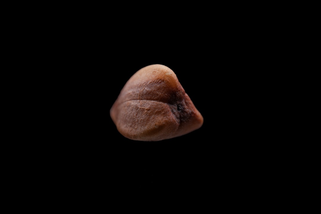 Prostate
