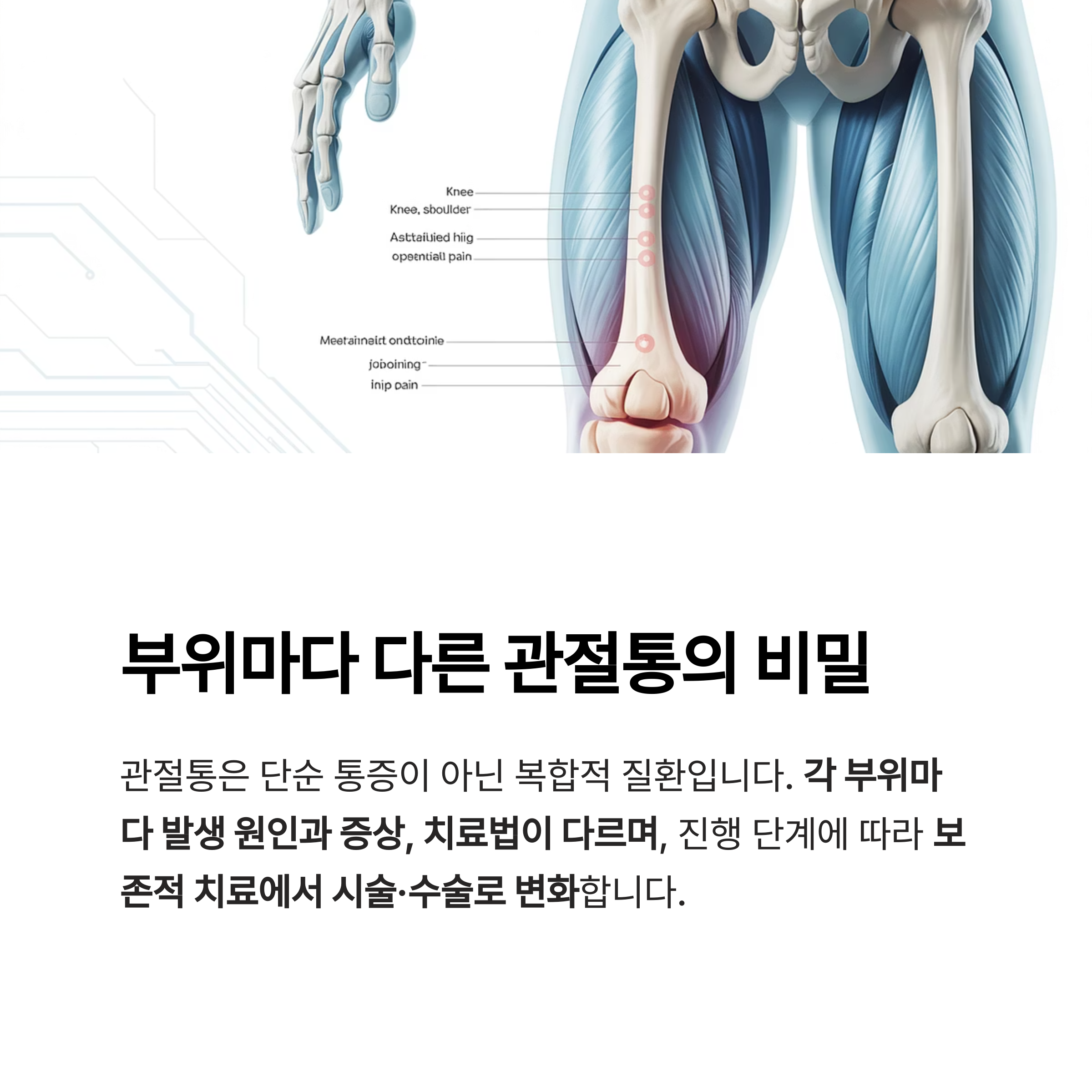 관절통 증상은 왜 부위마다 다를까?
