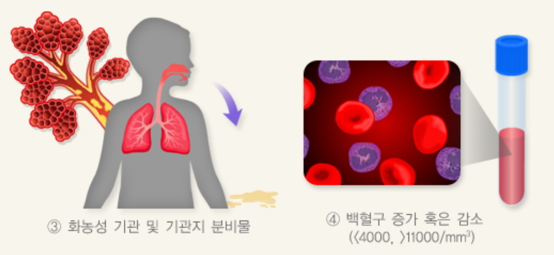 어린이 폐렴 진단 방법 2