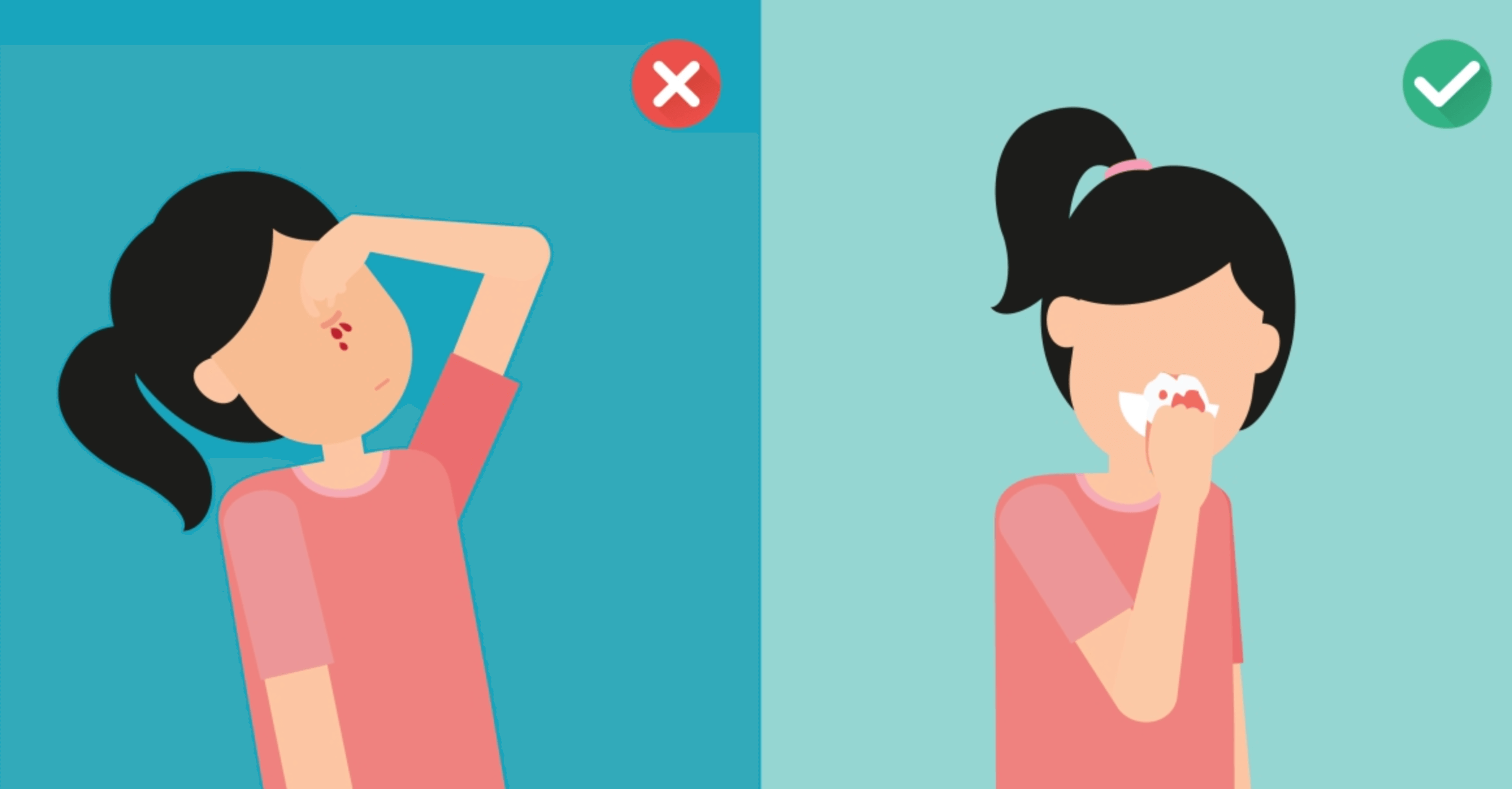 갑자기 코피 치료