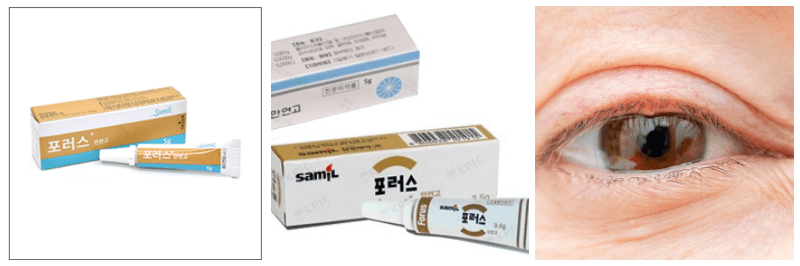 포러스 안연고, 다래끼 사진