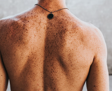 비오틴 효능 : 피부