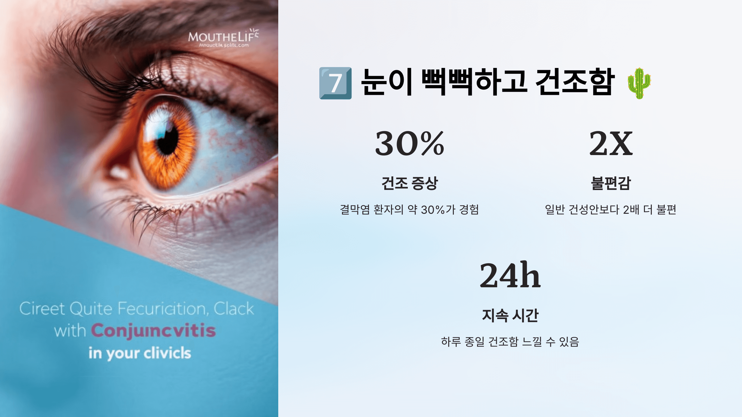 결막염과 관련된 사진입니다.