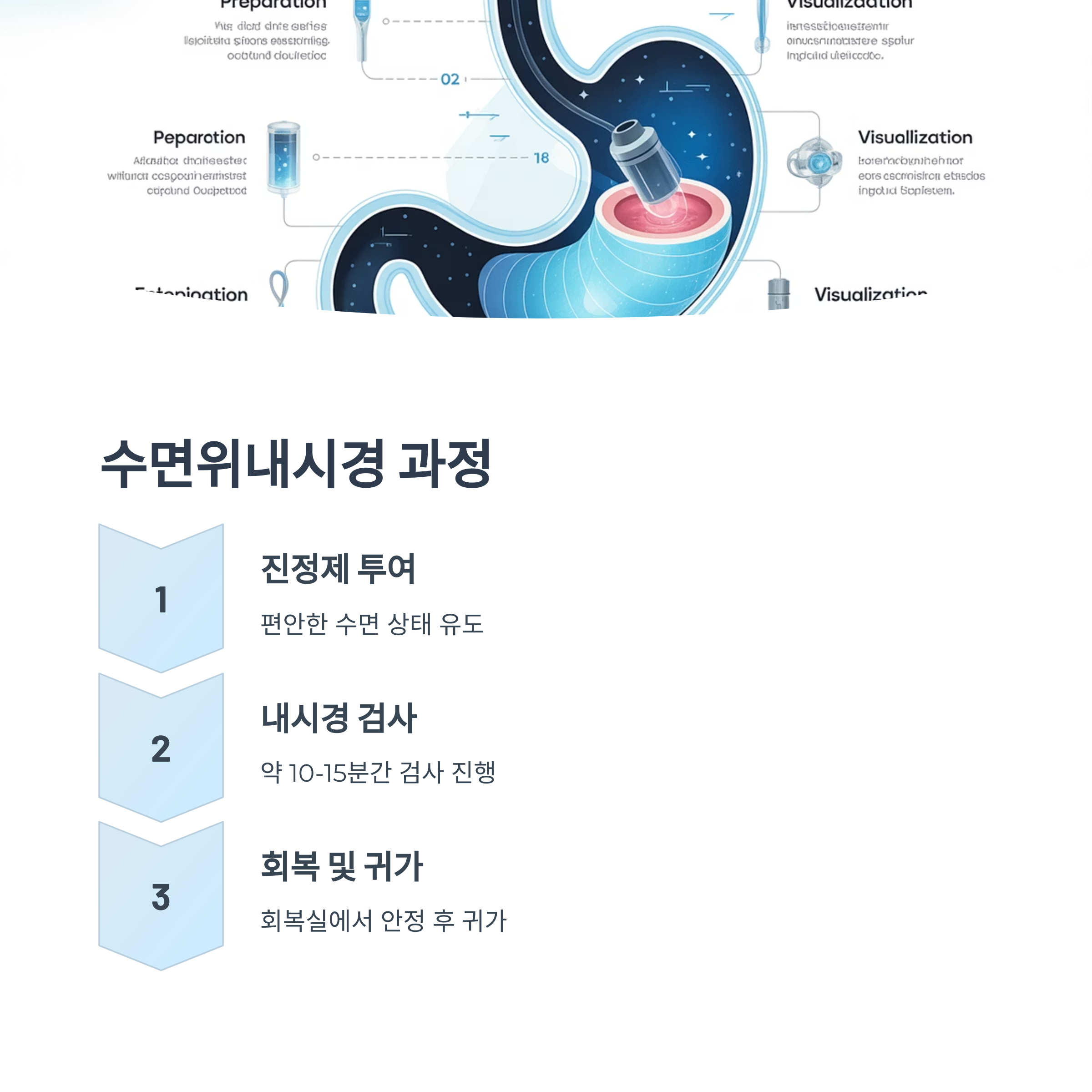 위내시경
