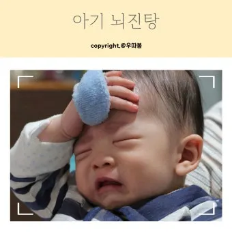 뇌진탕 초기 증상 후유증 으로_4