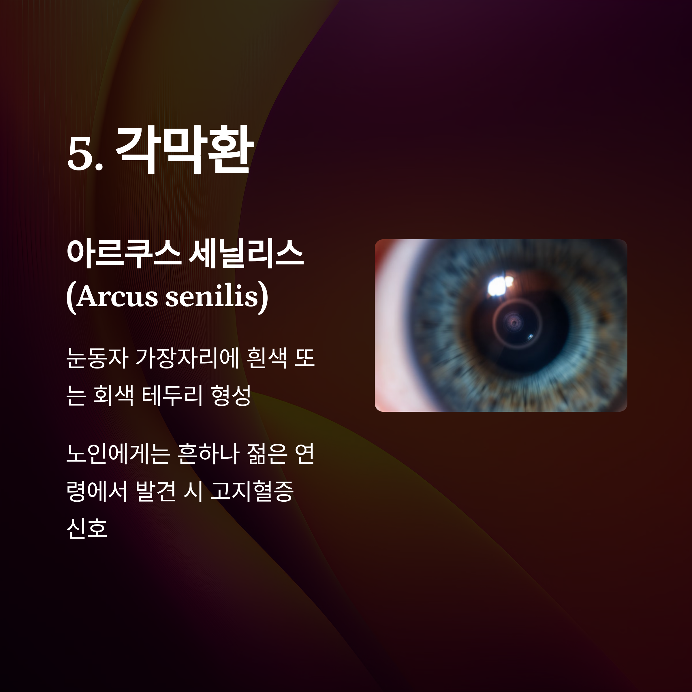 고지혈증 경고하는 5가지 신호