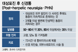 대상포진 초기증상