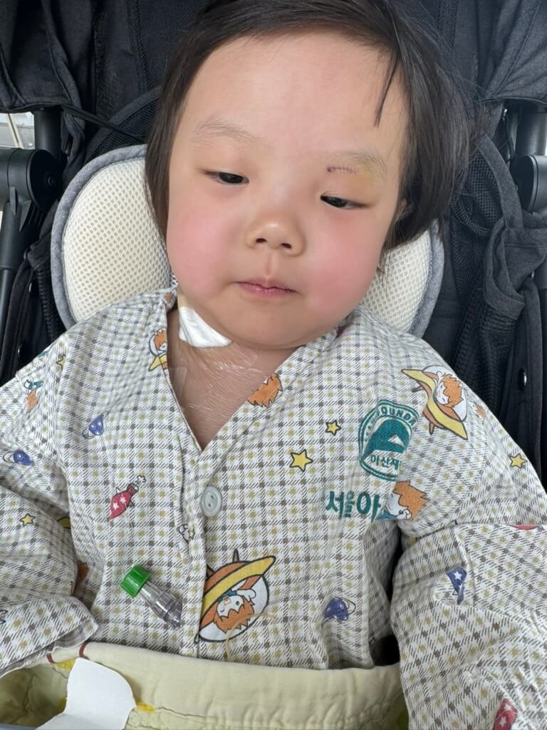 얼굴 부어있는 여자아이 사진