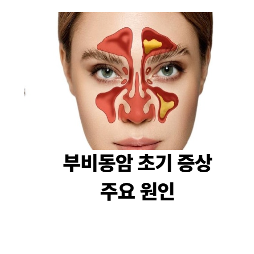 부비동암-초기-증상-및-주요-원인