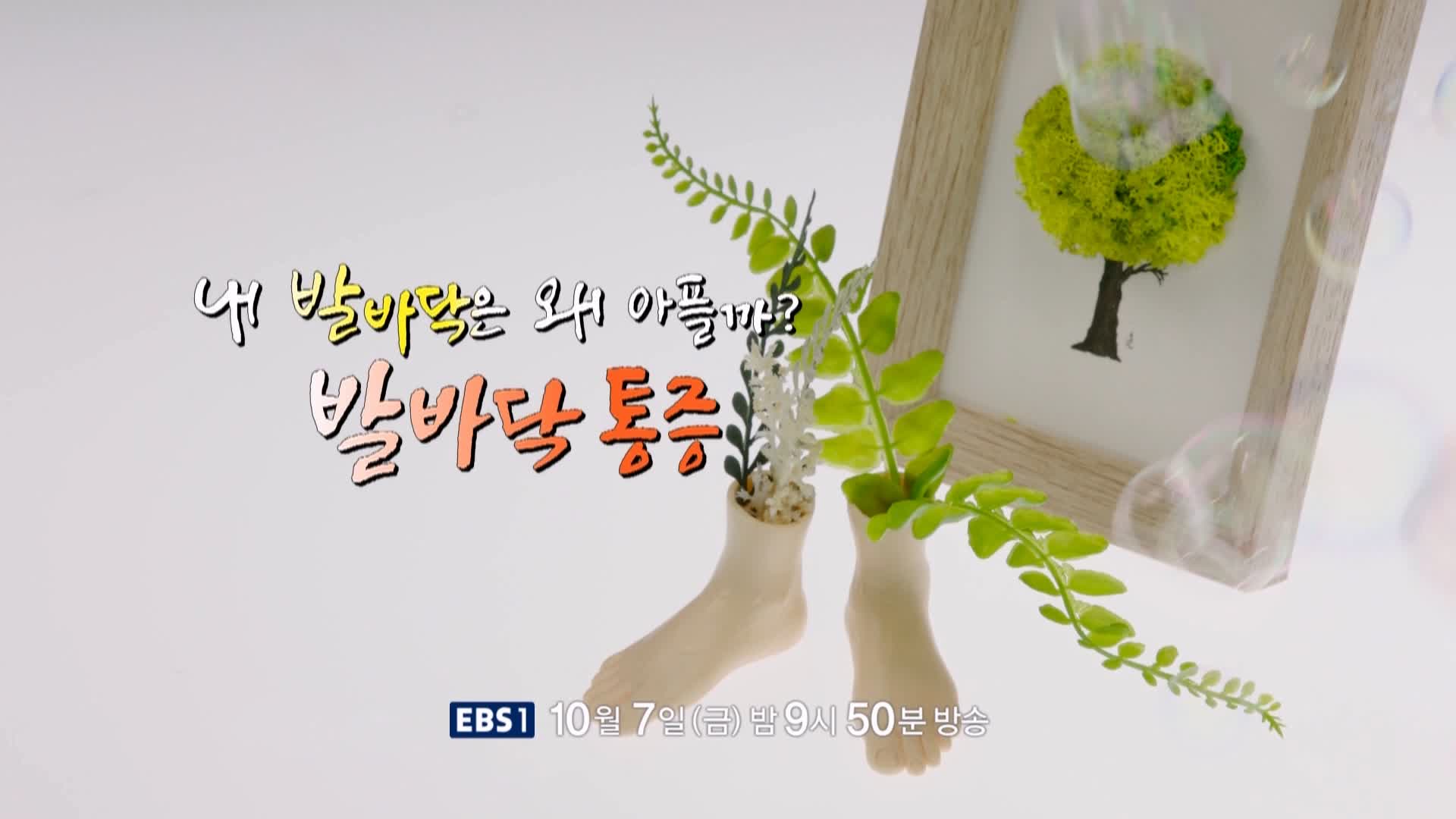 명의 족저근막염, 지간신경종, 무지외반증, 지방패드위축증후군 발바닥 통증 운동 치료