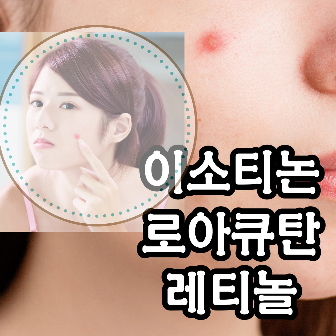 이소티논 로아큐탄 레티놀