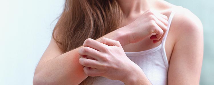 대상포진 초기증상