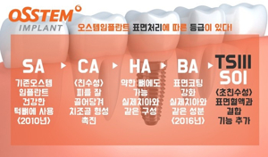 오스템임플란트 가격