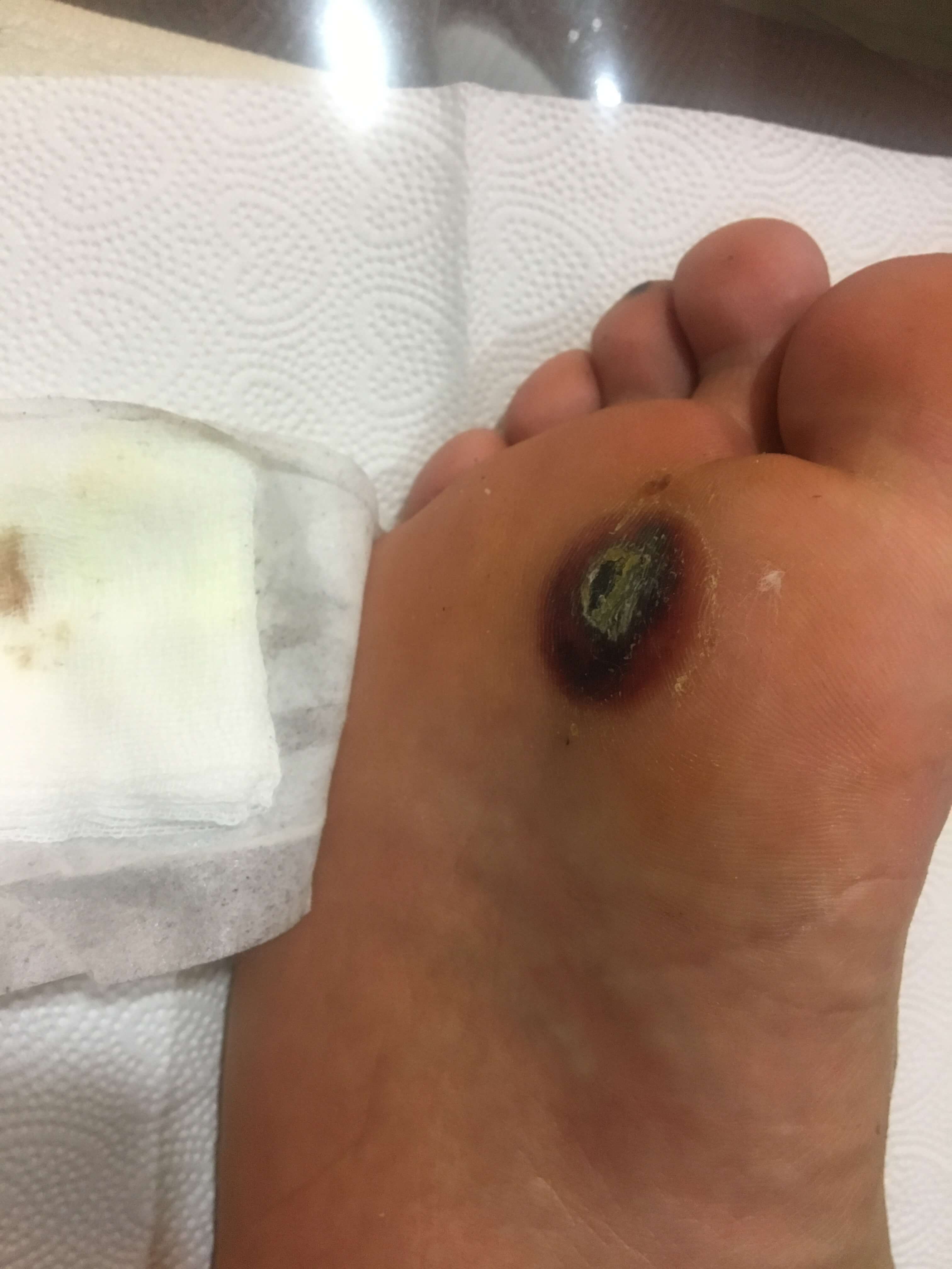 죽은 피부가 보입니다.