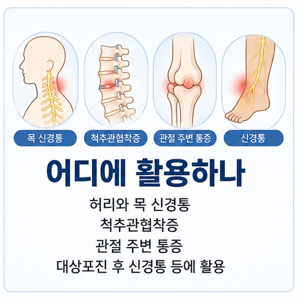 허리와 목의 신경통, 척추관협착증과 관절 주변 통증 등 다양한 통증에서 신경차단술이 활용될 수 있음을 보여 주는 그림