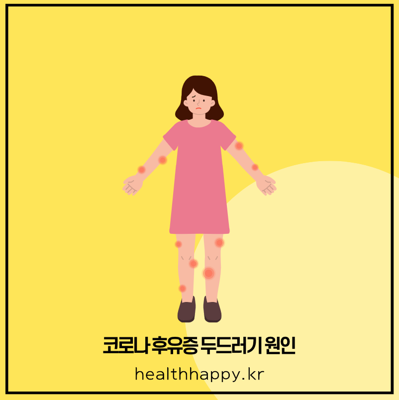 코로나 후유증 두드러기 원인