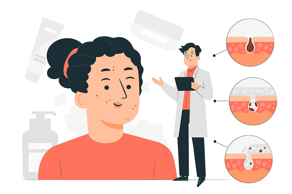 여드름-피부-개선-스킨케어-루틴