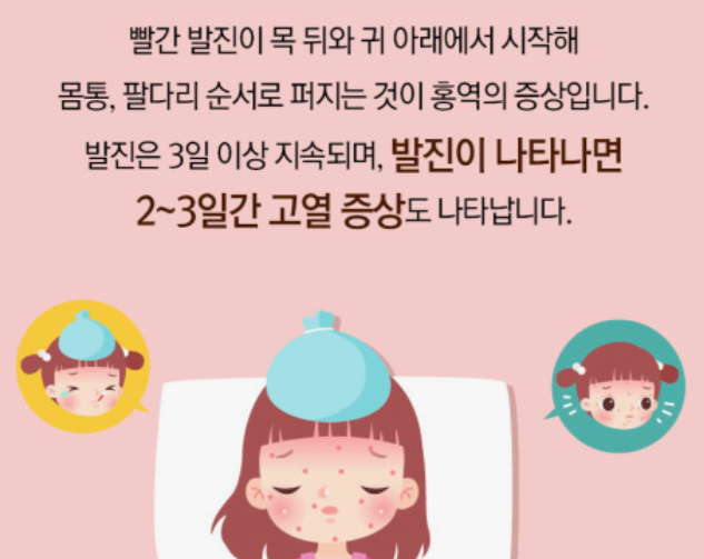 홍역-예방접종