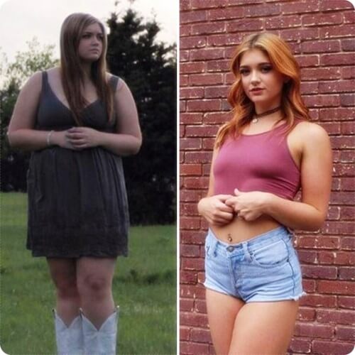 백인 여자 흔한 앨프