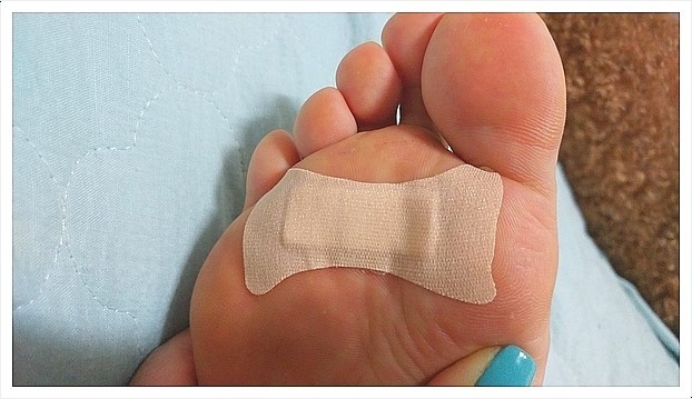 티눈-밴드사용-발바닥