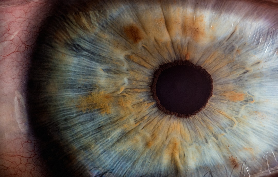 Eye exam