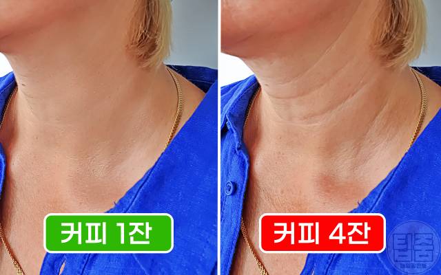 커피 많이 마시면 커피과다복용 부작용 피부노화 주름