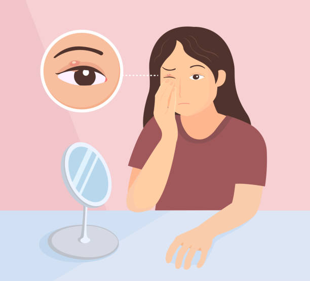 다래끼 빨리 낫는법