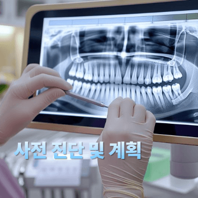 1단계: 사전 진단 및 계획