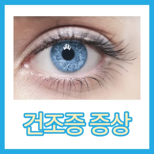 안구건조증 증상