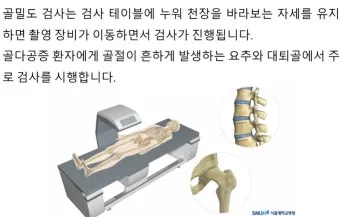 골밀도 검사 수치 골밀도 높이는 방법 간단 정리_3