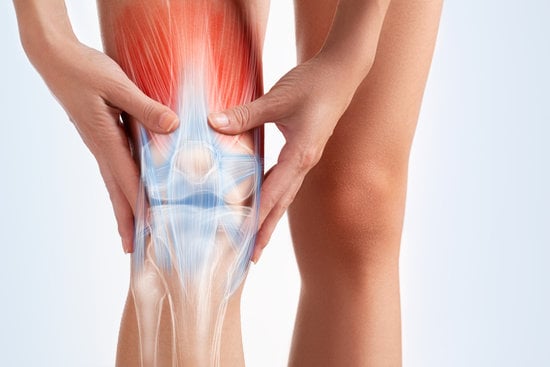고위 경골 절골술(High Tibial Osteotomy, HTO): 개요와 효과
