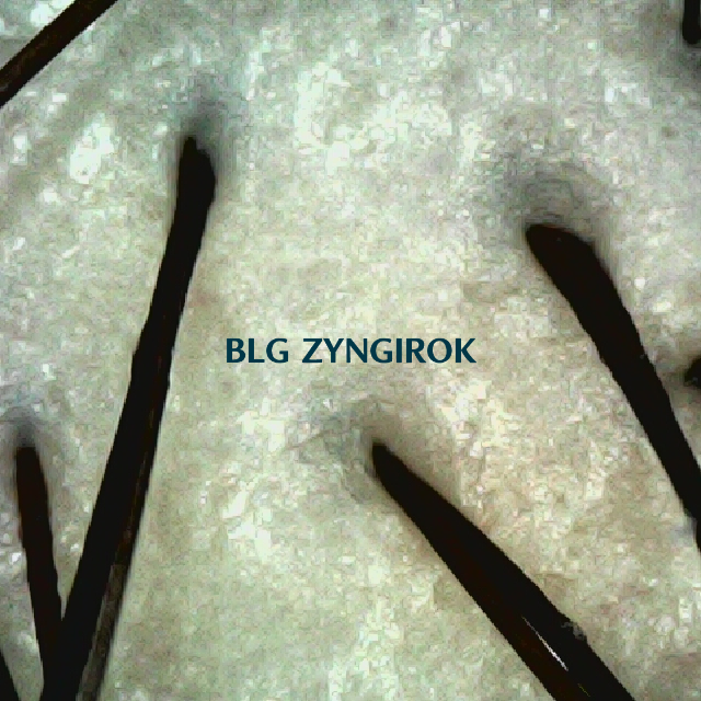 피나모아 복용 26주차 정수리 두피 모습이다.