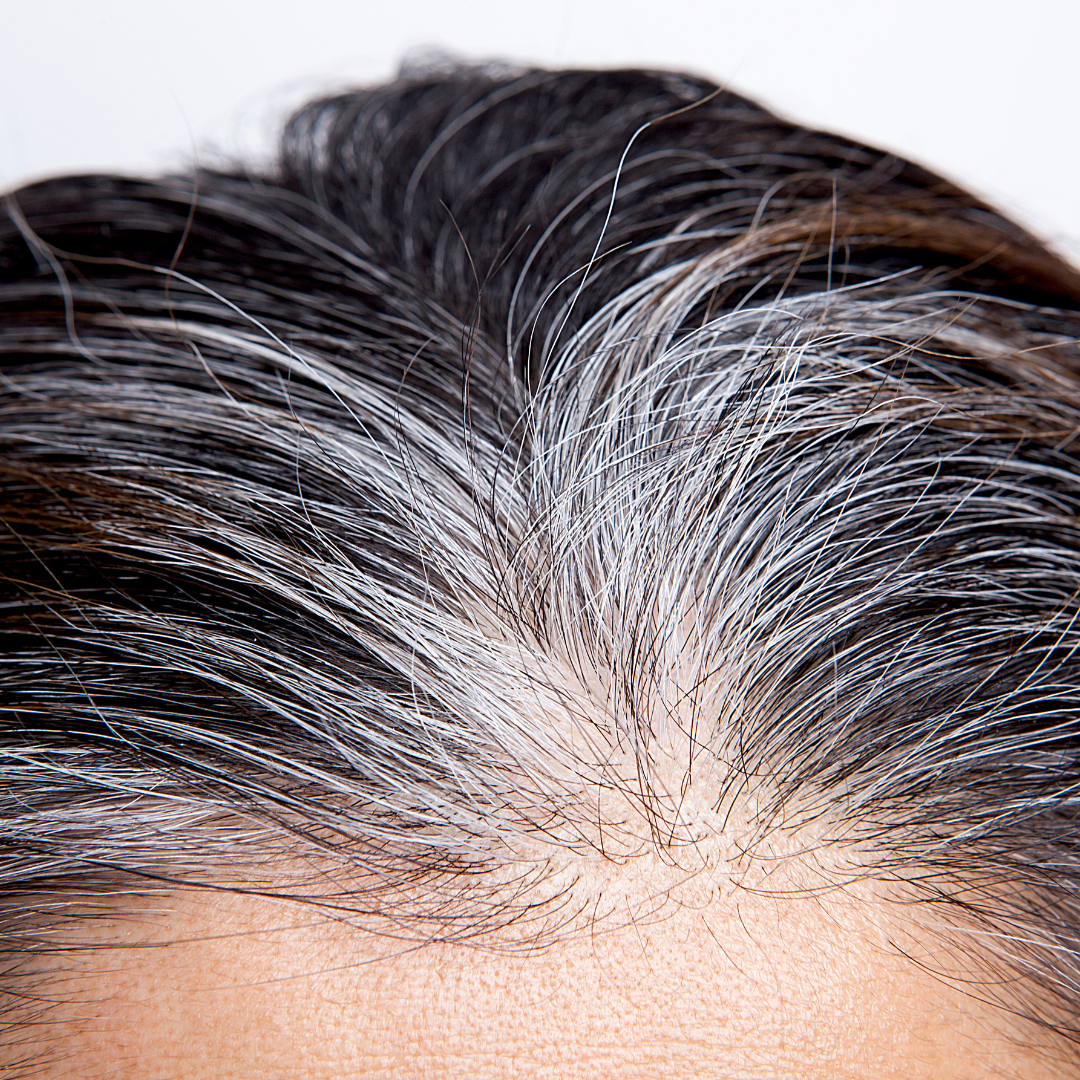 흰머리 나는 이유와 관리 방법, 효과적인 해결책