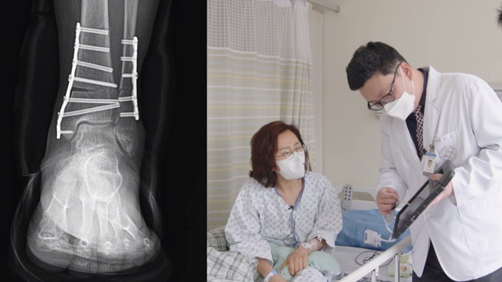 명의 엄홍길 치료 발이 편해야 사는 게 편하다 발 통증 발목 관절염