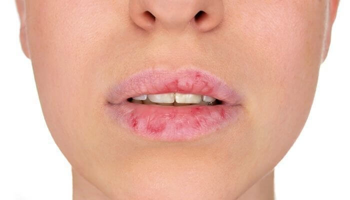 가을철 입술 보습 관리 방법을 보여주는 이미지로 립밤과 각질 제거 도구가 포함된 립케어 제품들이며 건조한 계절 촉촉한 입술 유지를 위한 스킨케어 루틴 소개