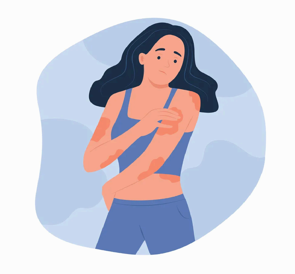 아토피 피부염, 올바른 보습 루틴으로 관리하기