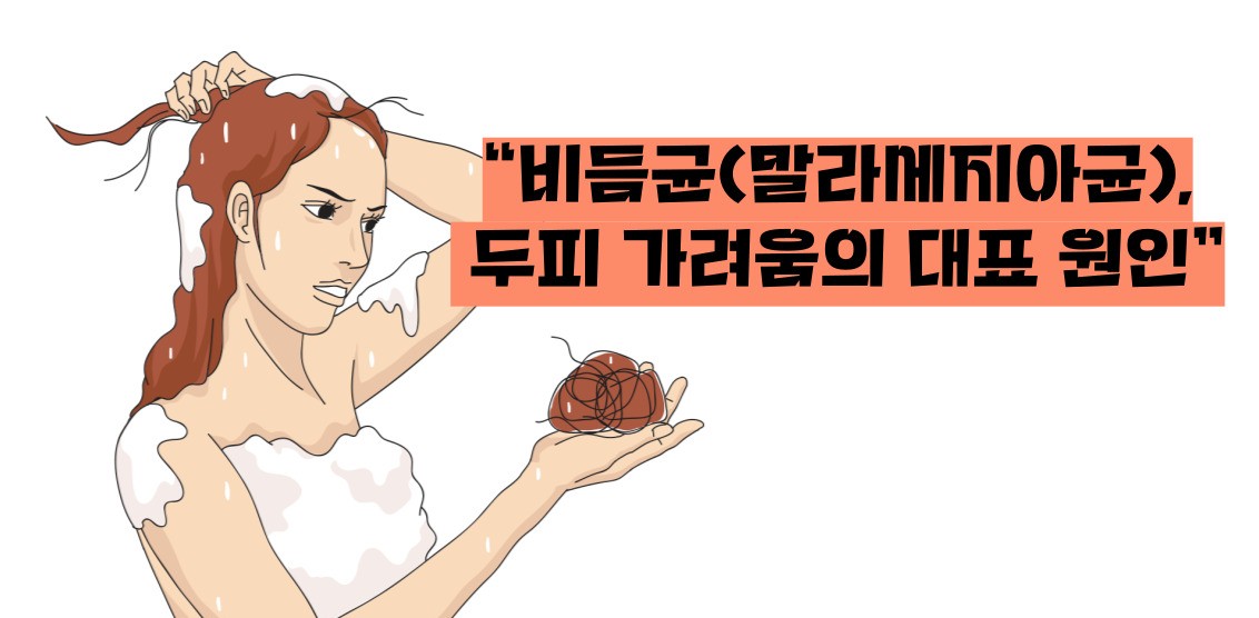 두피 가려움증 원인 치료