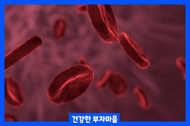 빈혈 종류 - 기립성, 철결핍