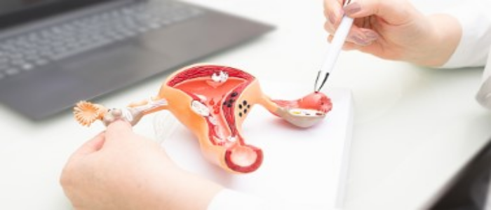 칸디다성 질염의 원인과 치료 방법