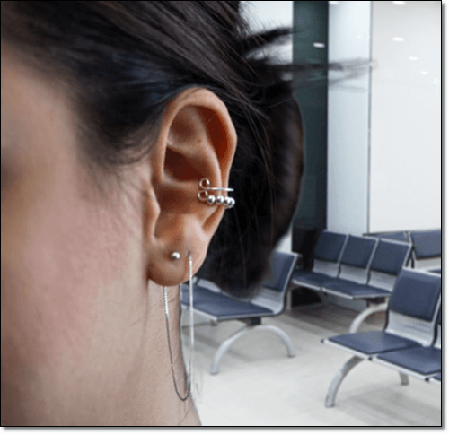표피낭종 원인이 되는 귀 피어싱