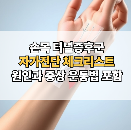 손목터널증후군-자가진단-원인-증상-치료-운동