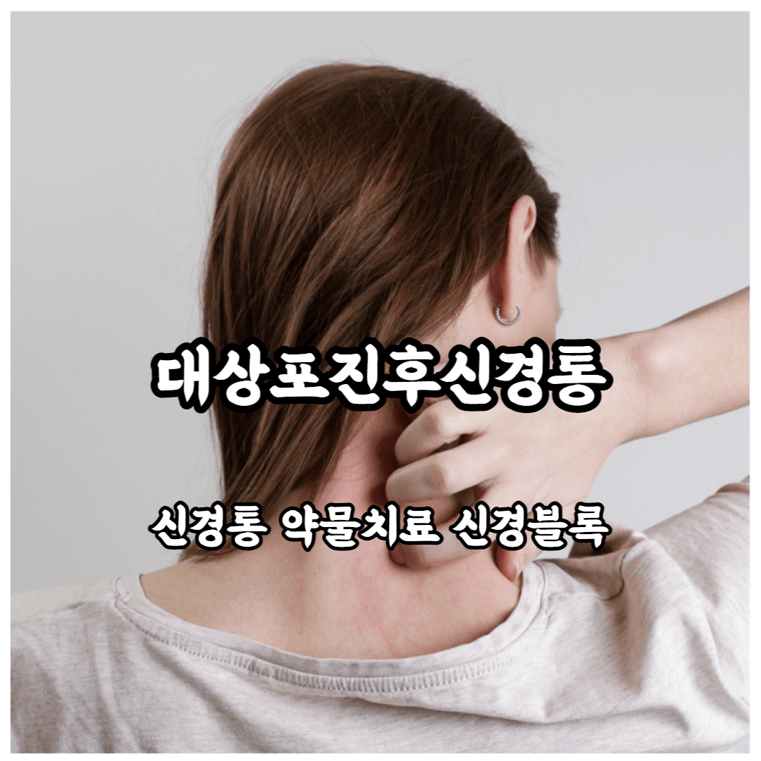 대상포진후신경통약물치료신경블록