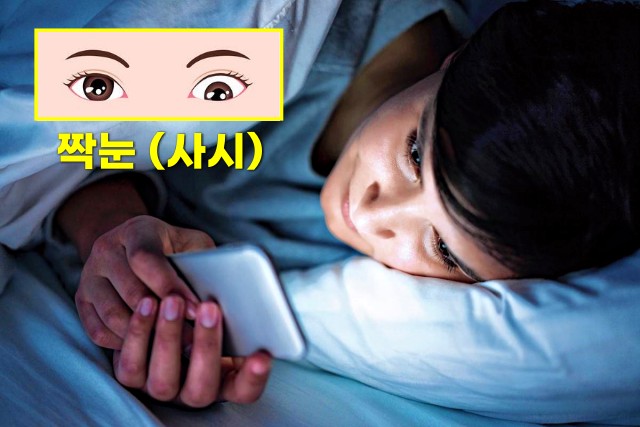 옆으로 누워서 스마트폰, 짝눈 시력 눈매 교정, 사시 부동시 원인