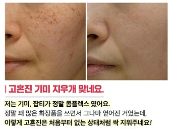고혼진 화장품 가격, 성분, 효능 까지 완벽 분석!