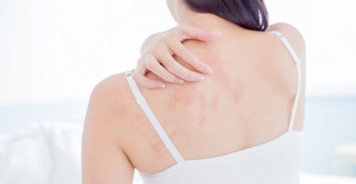 목뒤-등을긁는여자-뒷모습