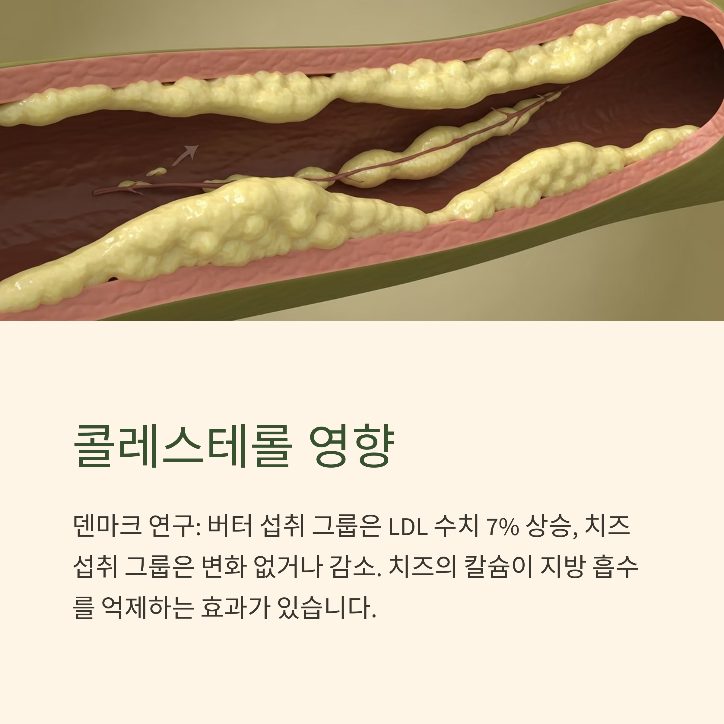 콜레스테롤 영향