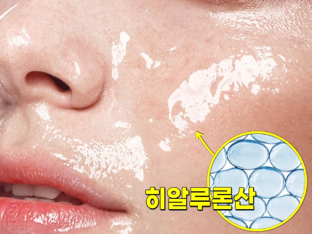 물광주사 히알루론산, 젖산, 우레아, 보습제, 손이 갈라지고 벗겨져요 피부 건조증 예방 치료법, 팁줌