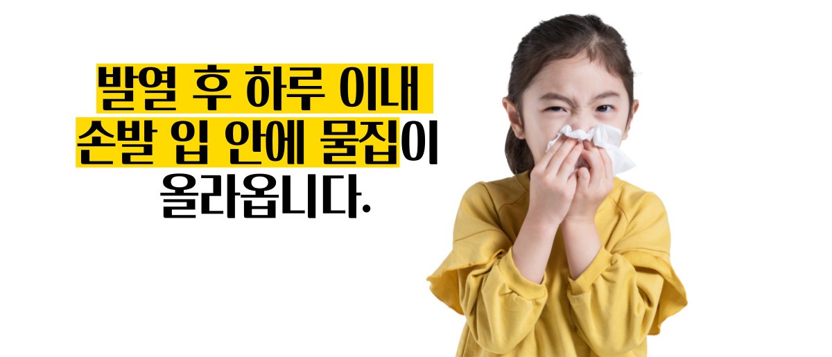 수족구 증상