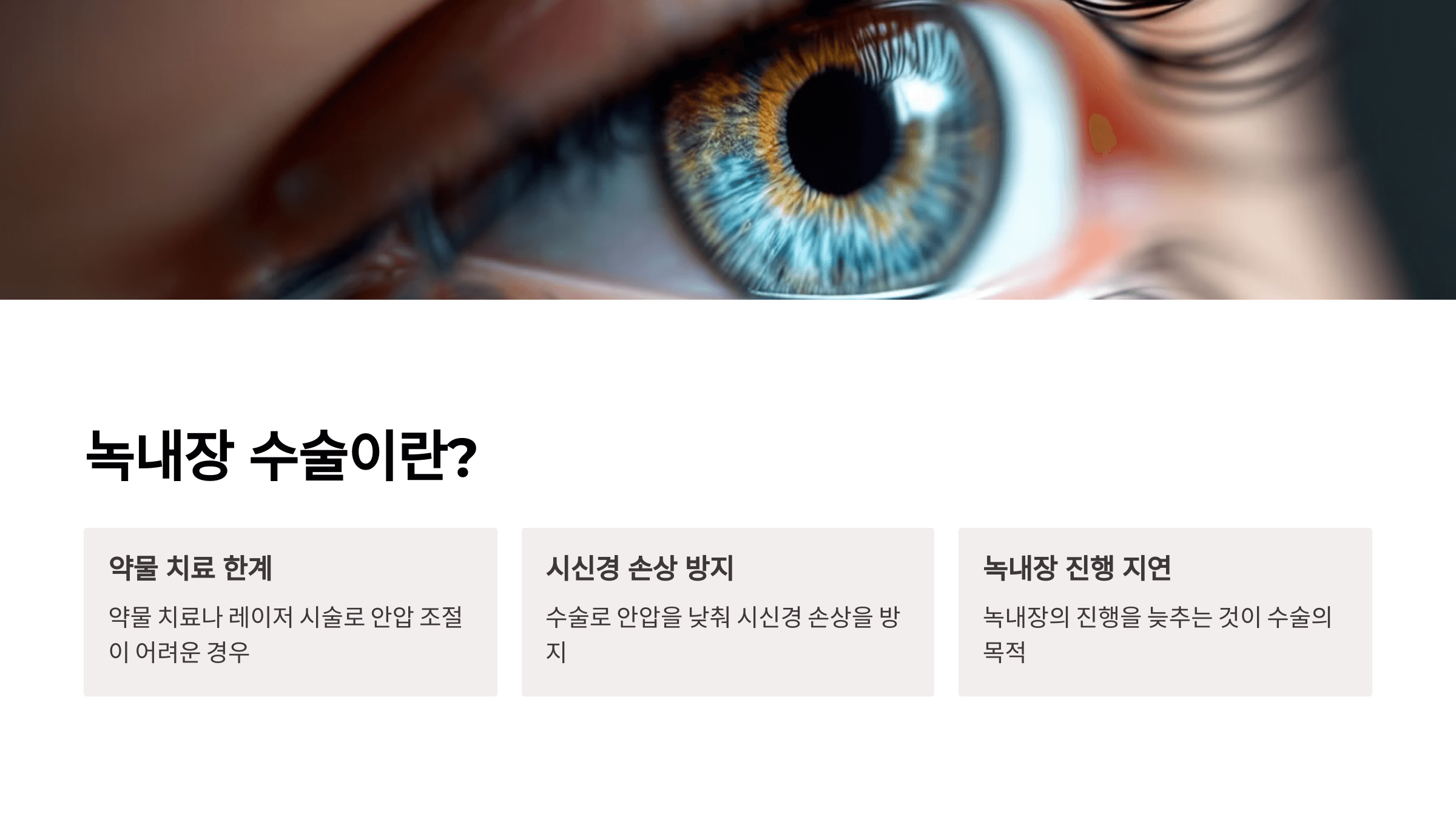 녹내장과 관련된 사진입니다.