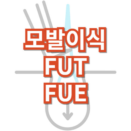 모발이식-절개-비절개-방법